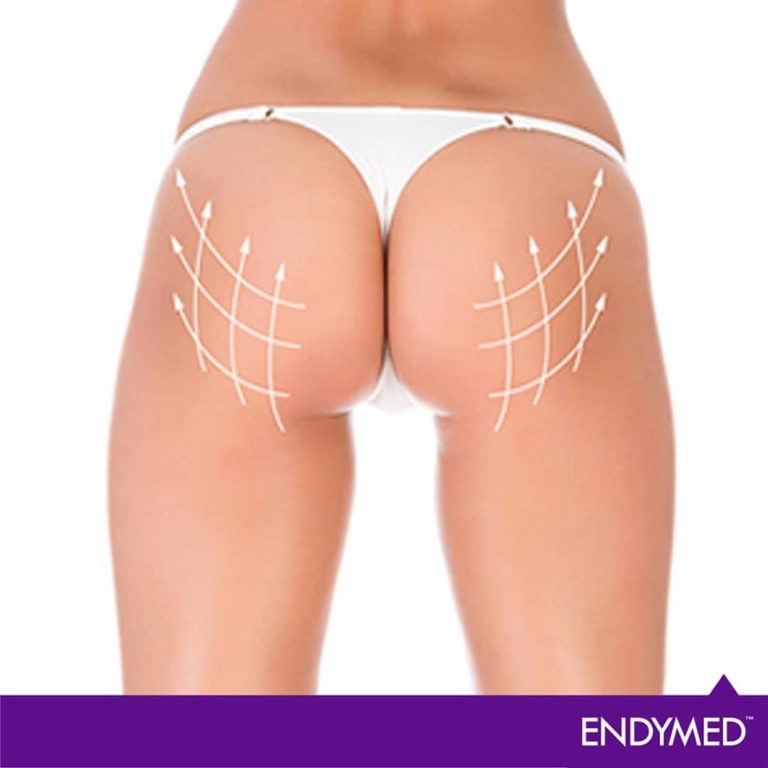 ENDYMED CONTOUR4