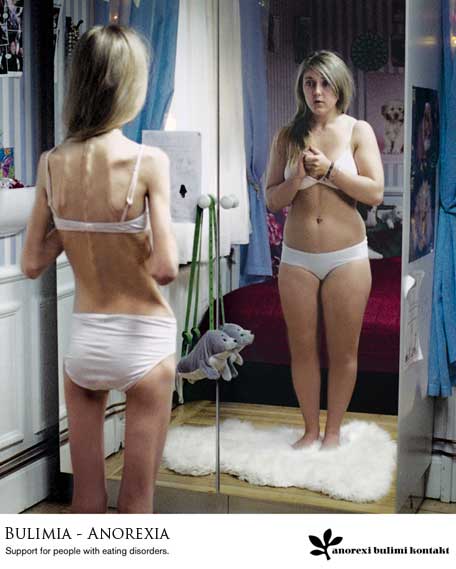 anorexia y bulimia