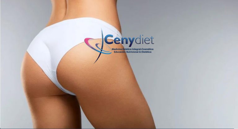 eliminar celulitis en glúteos